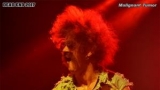 Malignant Tumour (56 / 92)